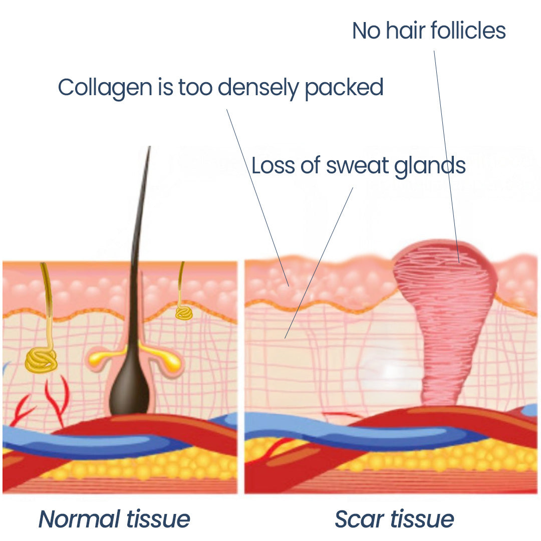 KUBOZN® Triple-Roller Microcurrent ScarRepair Gel