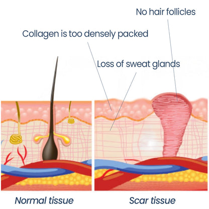 KUBOZN® Triple-Roller Microcurrent ScarRepair Gel