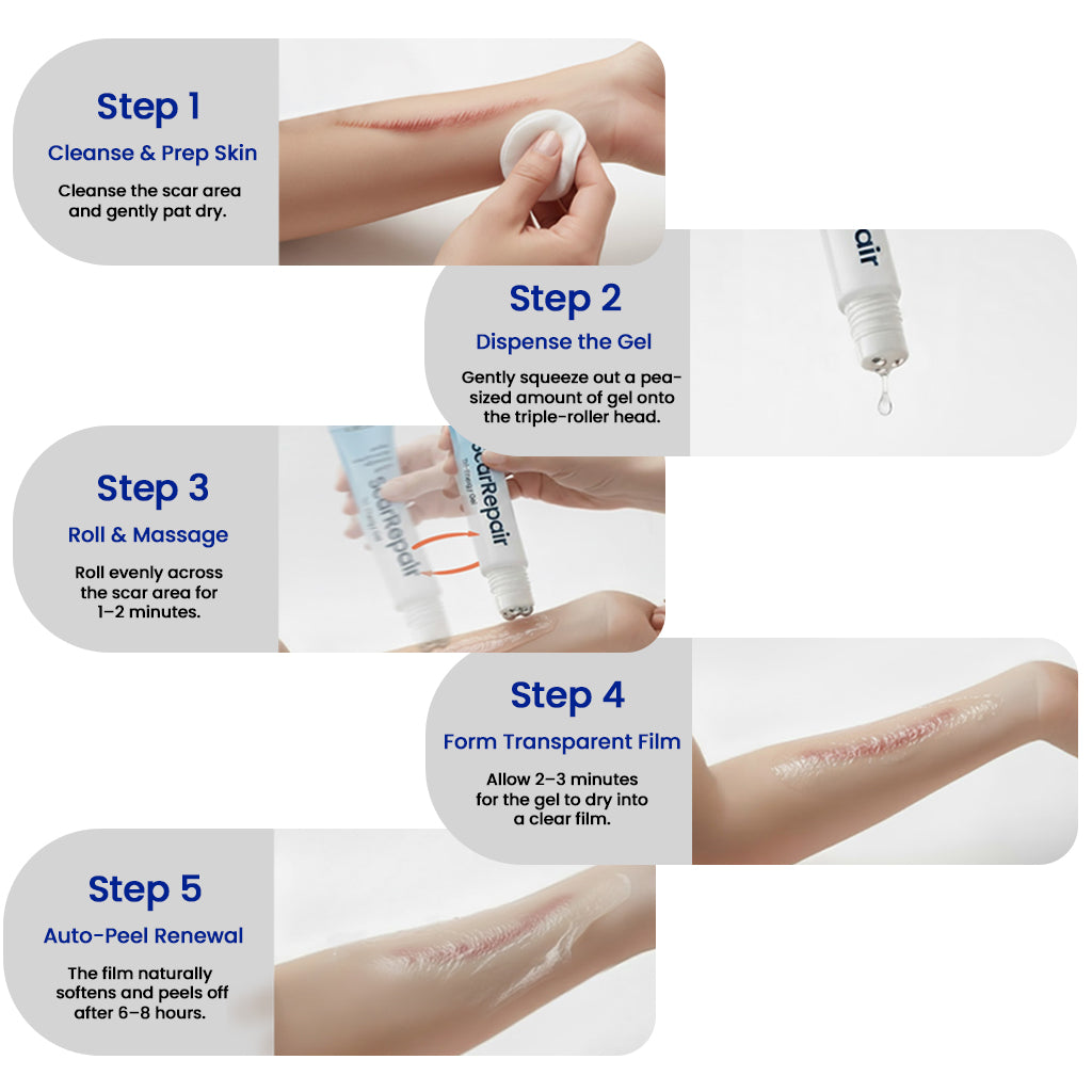 KUBOZN® Triple-Roller Microcurrent ScarRepair Gel