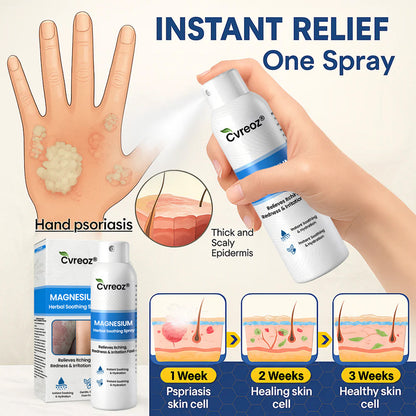 ✅  Official Store: Cvreoz® Magnesium Herbal Psoriasis Spray ⚕️ (Offer)