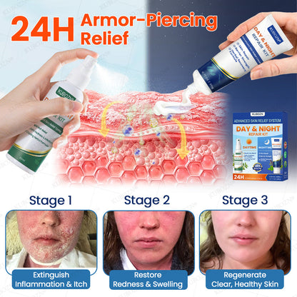 KUBOZN® Psoriasis Day & Night Repair System - 100% Steroid-Free Relief Duo for Plaques, Scaling & Itch
