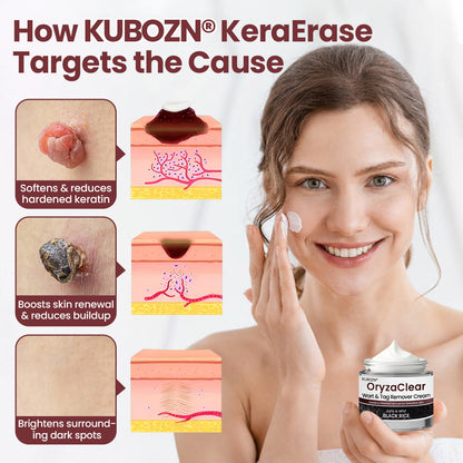 KUBOZN®KeraErase Dual-Action Renewal Cream (Offer)