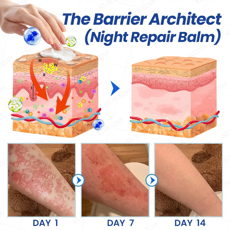 KUBOZN® Psoriasis Day & Night Repair System - 100% Steroid-Free Relief Duo for Plaques, Scaling & Itch