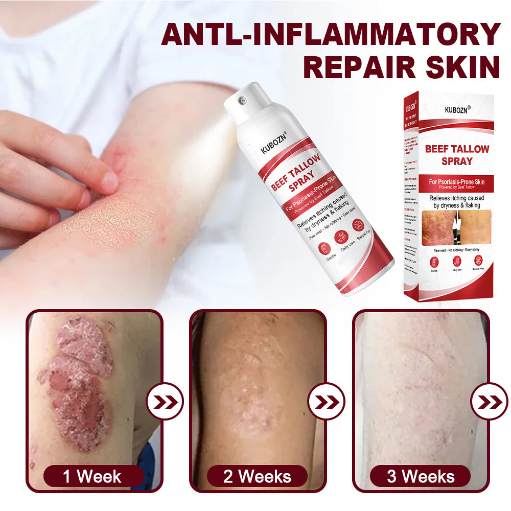 KUBOZN® Beef Tallow Spray for Itchy, Flaky Psoriasis Skin 1
