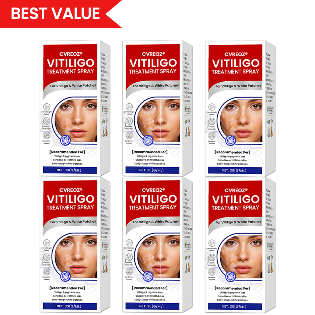 Cvreoz®Vitiligo Treatment Spray — Visible Results in Weeks, 100% Natural & Steroid-Free (Offer)