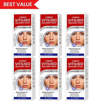 Cvreoz®Vitiligo Treatment Spray — Visible Results in Weeks, 100% Natural & Steroid-Free
