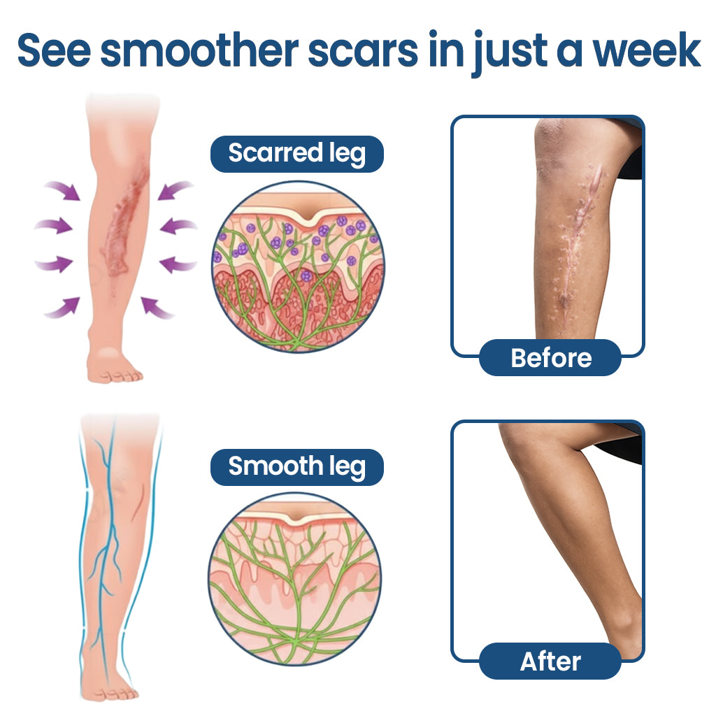 KUBOZN® Triple-Roller Microcurrent ScarRepair Gel (Offer)