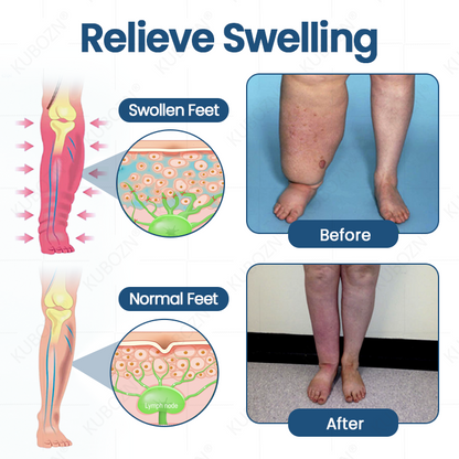✨KUBOZN® Roll-On Cream for Lymphatic Drainage & Swelling Relief
