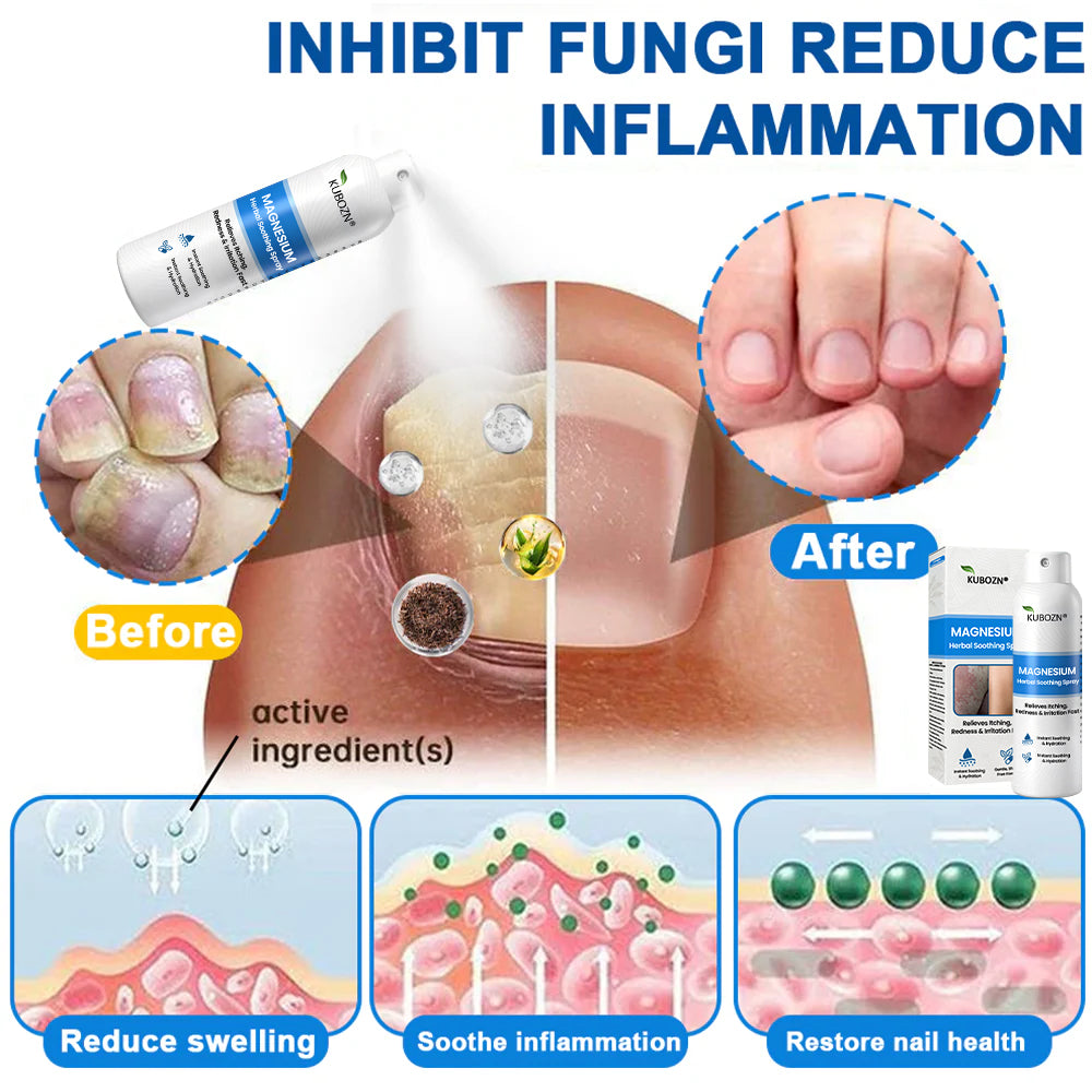 ✅  Official Store: KUBOZN® Magnesium Herbal Psoriasis Spray ⚕️ (Offer)