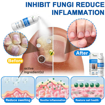 ✅  Official Store: KUBOZN® Magnesium Herbal Psoriasis Spray ⚕️ (Offer)