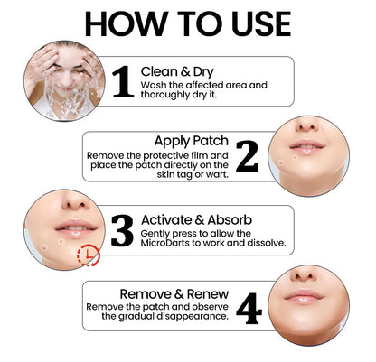 ✨ KUBOZN® Pro MicroDarts TAG'Gone Patch