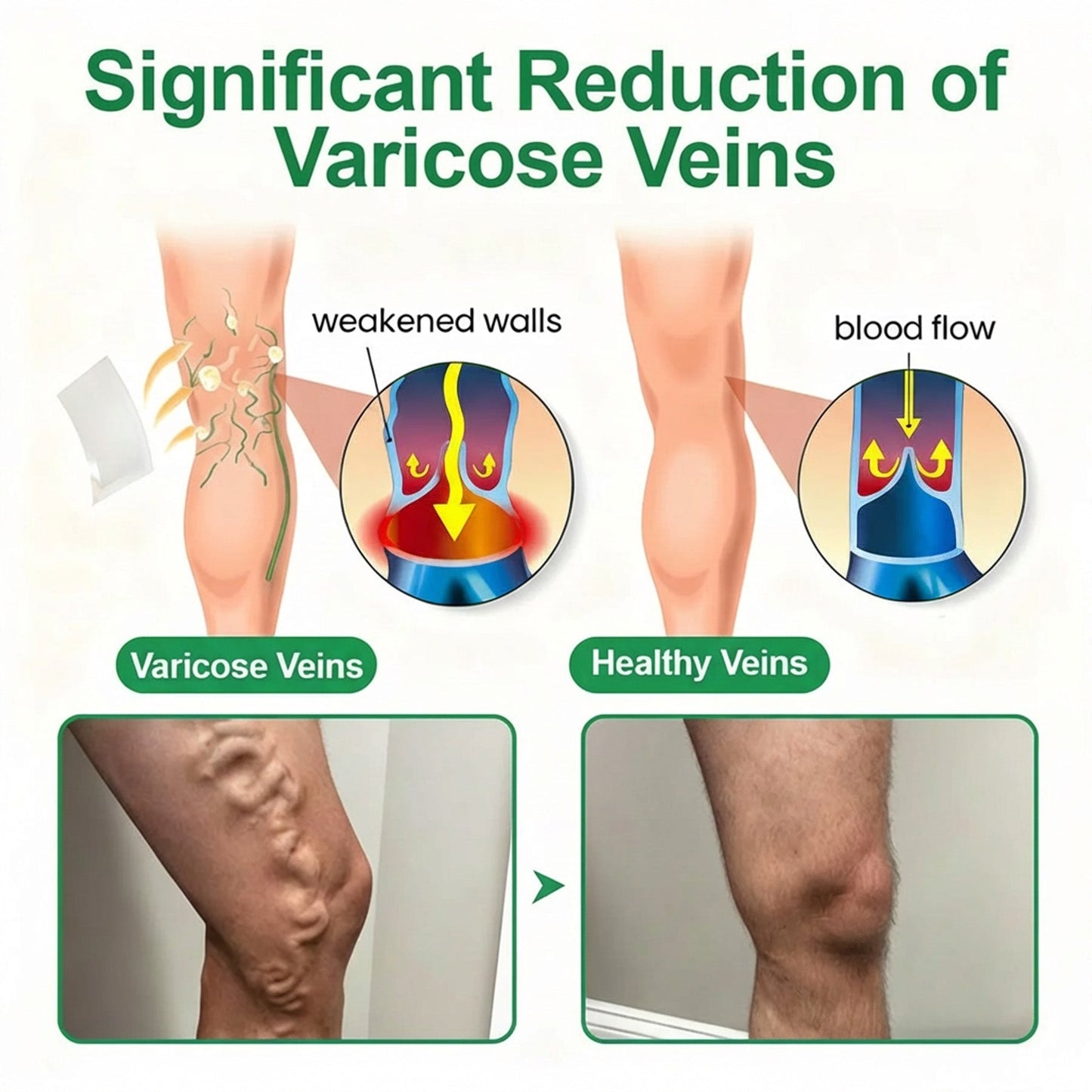Healrize® VeinEase Microneedle Care Patch⚡Instant Relief, Long-Term Results