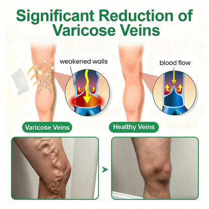 Healrize® VeinEase Microneedle Care Patch⚡Instant Relief, Long-Term Results