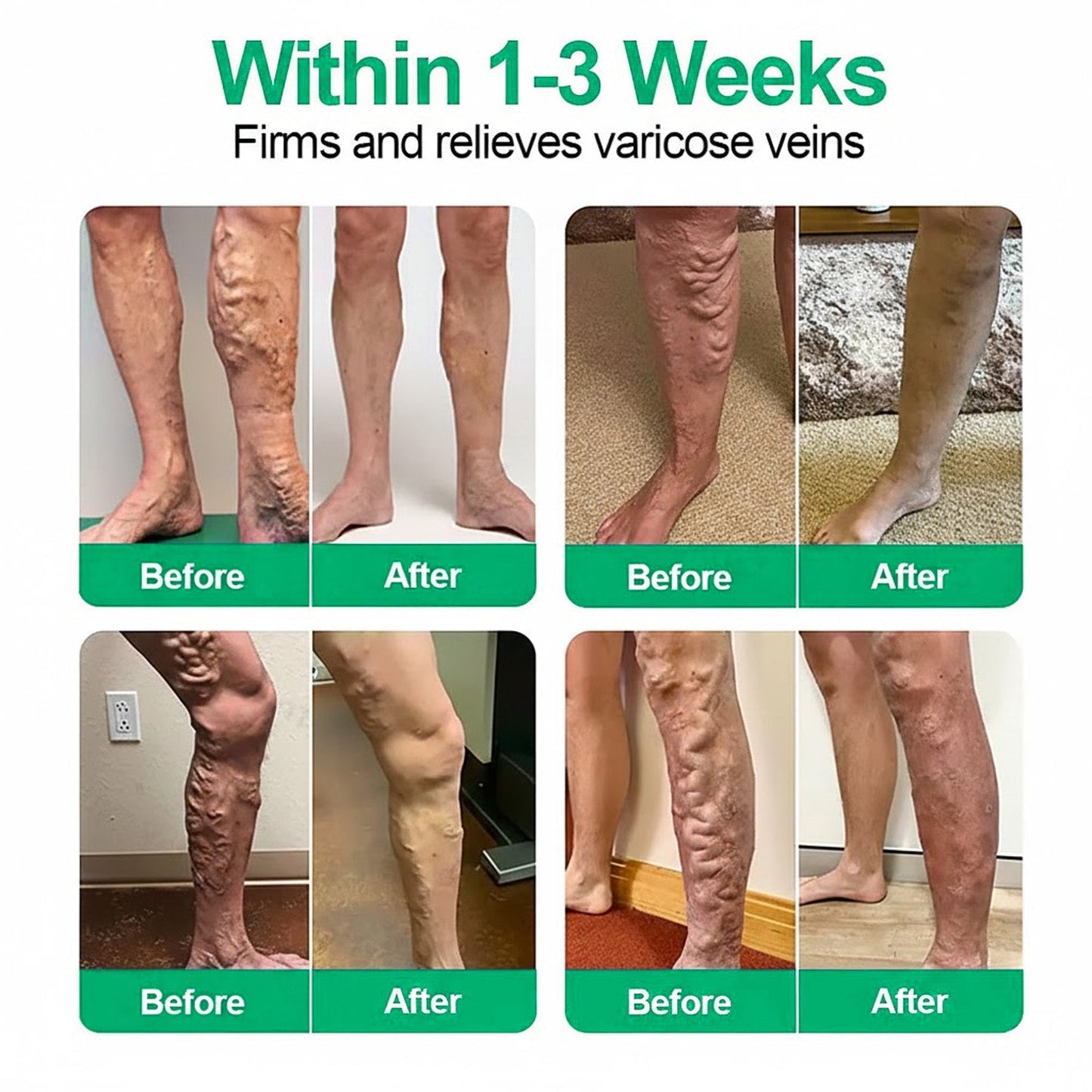 Healrize® VeinEase Microneedle Care Patch⚡Instant Relief, Long-Term Results