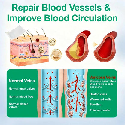 Healrize® VeinEase Microneedle Care Patch⚡Instant Relief, Long-Term Results